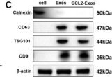 Fig.5.C showing Western Blotting from the publication: Single-Cell Sequencing Reveals That CCL2+ Adipose-Derived Stem Cells Promote Diabetic Wound Healing Through the CCL2-ACKR1 Signaling Axis.