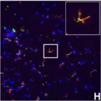 Fig.7.H showing Immunohistochemistry-immunofluorescence in a Mus musculus (House mouse) sample from the publication: IFN-gamma signaling in the central nervous system controls the course of experimental autoimmune encephalomyelitis independently of the localization and composition of inflammatory foci.