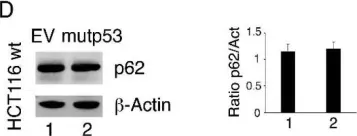 Fig.5.D showing Western Blotting from the publication: p53-R273H Sustains ROS, Pro-Inflammatory Cytokine Release and mTOR Activation While Reducing Autophagy, Mitophagy and UCP2 Expression, Effects Prevented by wtp53.