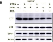 PDRN prevents SIRT1 degradation by attenuating autophagy during skin aging.
