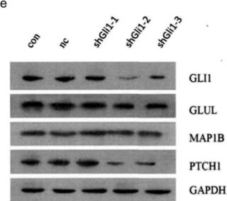 Fig.3.E showing Western Blotting in a Homo sapiens (Human) sample from the publication: Hsa-mir-1293/GLI1/PTCH1 axis is involved in proliferation, migration, and EMT of laryngeal cancer.