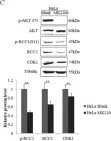 Fig.5.C showing Western Blotting from the publication: Phosphorylation of RCC1 on Serine 11 Facilitates G1/S Transition in HPV E7-Expressing Cells.