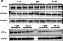 Fig.5.F showing Western Blotting in a Mus musculus (House mouse) sample from the publication: USP9X as a Candidate Mediator of Prenatal Aspirin-Induced Ovarian Reserve Reduction in Offspring Mice.