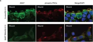 Fig.8.C showing Immunocytochemistry-immunofluorescence from the publication: BART inhibits pancreatic cancer cell invasion by PKCα inactivation through binding to ANX7.