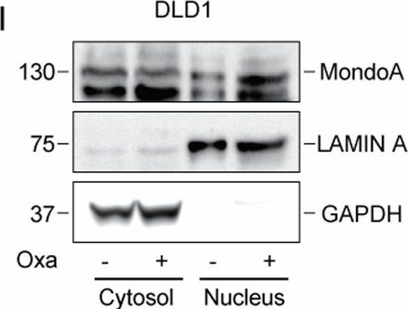 Fig.10.I showing Western Blotting in a Homo sapiens (Human) sample from the publication: The MondoA-dependent TXNIP/GDF15 axis predicts oxaliplatin response in colorectal adenocarcinomas.