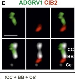 Fig.5.E showing Immunocytochemistry-immunofluorescence in a Mus musculus (House mouse) sample from the publication: Usher syndrome proteins ADGRV1 (USH2C) and CIB2 (USH1J) interact and share a common interactome containing TRiC/CCT-BBS chaperonins.