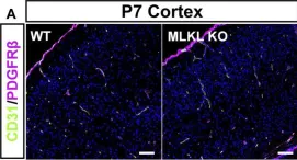 Fig.2.A showing Immunohistochemistry-immunofluorescence in a Mus musculus (House mouse) sample from the publication: Evidence for developmental vascular-associated necroptosis and its contribution to venous-lymphatic endothelial differentiation.