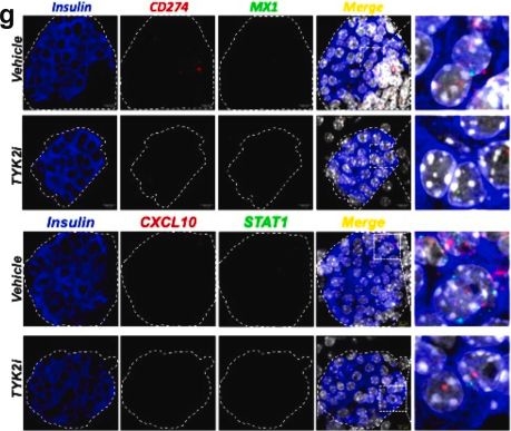 Fig.5.G showing Immunocytochemistry-immunofluorescence from the publication: Pharmacological inhibition of tyrosine protein-kinase 2 reduces islet inflammation and delays type 1 diabetes onset in mice.