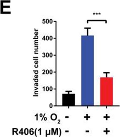Fig.6.E from the publication: Hypoxia promotes metastasis by relieving miR-598-3p-restricted glycolysis in gastric cancer.