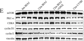 Fig.7.E showing Western Blotting in a Mus musculus (House mouse) sample from the publication: Inhibition of the immunoproteasome modulates innate immunity to ameliorate muscle pathology of dysferlin-deficient BlAJ mice.