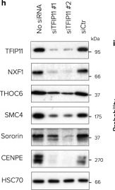 Fig.7.H showing Western Blotting in a Homo sapiens (Human) sample from the publication: DHX15-independent roles for TFIP11 in U6 snRNA modification, U4/U6.U5 tri-snRNP assembly and pre-mRNA splicing fidelity.