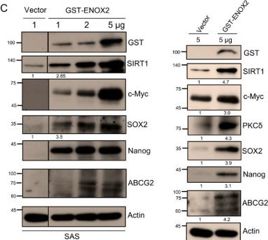 Fig.4.C showing Western Blotting from the publication: ENOX2 (tNOX)-Associated Stemness in Oral Cancer Cells and Its Clinical Correlation in Head and Neck Tumors.