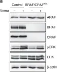 Fig.7.A showing Western Blotting in a Homo sapiens (Human) sample from the publication: RAF proteins exert both specific and compensatory functions during tumour progression of NRAS-driven melanoma.