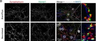 Fig.3.D showing Immunocytochemistry-immunofluorescence in a Mus musculus (House mouse) sample from the publication: Procedures for Culturing and Genetically Manipulating Murine Hippocampal Postnatal Neurons.