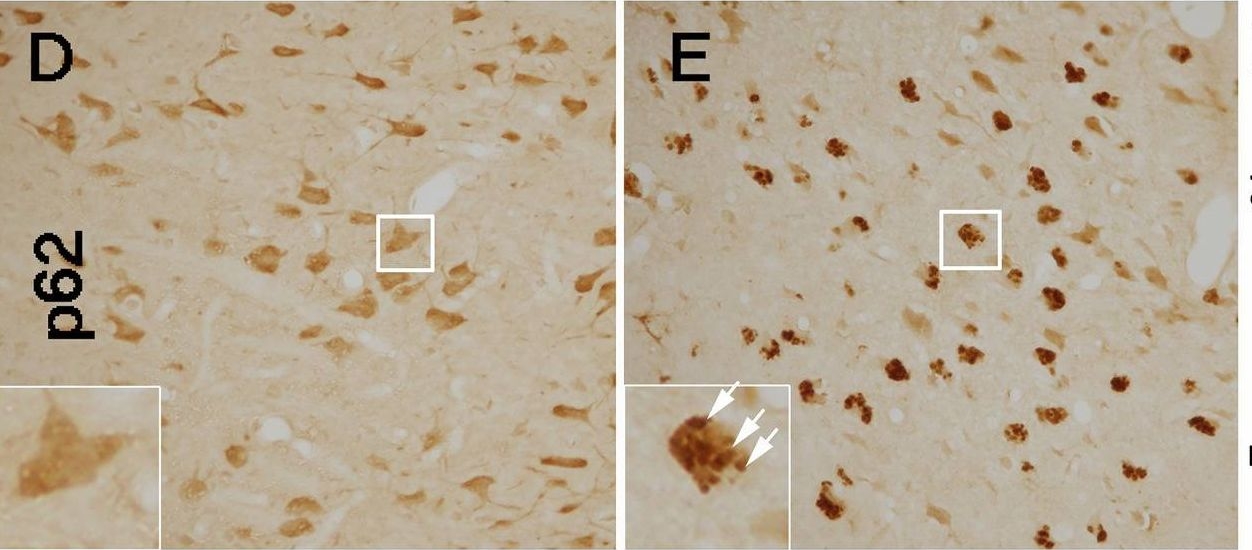 Lack of Cathepsin D in the central nervous system results in microglia and astrocyte activation and the accumulation of proteinopathy-related proteins.