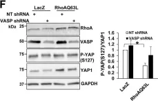 Fig.4.F showing Western Blotting from the publication: Vasodilator-stimulated phosphoprotein promotes liver metastasis of gastrointestinal cancer by activating a β1-integrin-FAK-YAP1/TAZ signaling pathway.