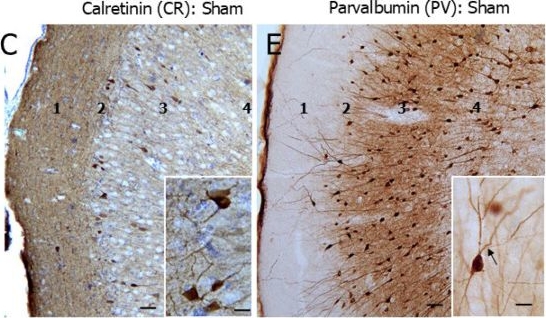 Fig.4.C showing Immunohistochemistry from the publication: Calretinin and Parvalbumin Trapping of TDP43 and XRCC1 Instructs Neocortical Interneuron Death in Neonatal Hypoxic-Ischemic Encephalopathy.