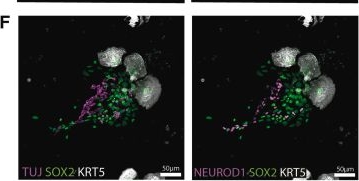 Fig.1.F showing Immunohistochemistry-immunofluorescence in a Mus musculus (House mouse) sample from the publication: Quiescent horizontal basal stem cells act as a niche for olfactory neurogenesis in a mouse 3D organoid model.