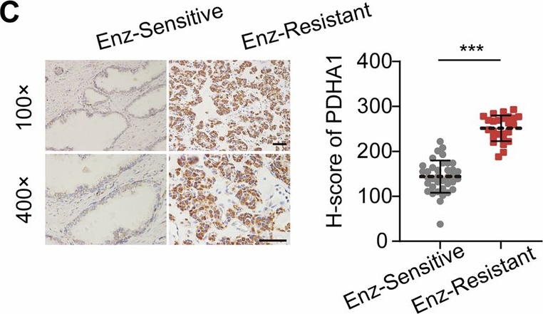 Fig.2.C showing Immunohistochemistry from the publication: PDHA1-acetylation signaling suppresses cuproptosis to attenuate anti-androgen effect in prostate cancer.