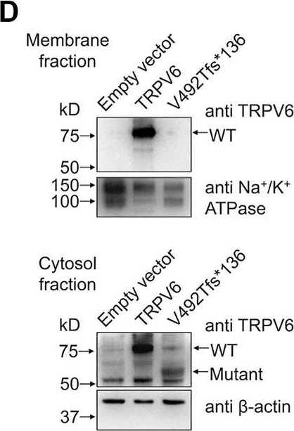 Fig.2.D showing Western Blotting in a Homo sapiens (Human) sample from the publication: A novel frameshift mutation in TRPV6 is associated with hereditary pancreatitis.