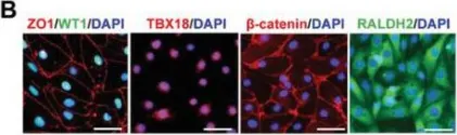 Fig.1.B showing Immunocytochemistry-immunofluorescence from the publication: hESC-Derived Epicardial Cells Promote Repair of Infarcted Hearts in Mouse and Swine.
