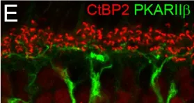 Fig.1.E showing Immunohistochemistry-immunofluorescence in a Mus musculus (House mouse) sample from the publication: Dendritic stratification differs among retinal OFF bipolar cell types in the absence of rod photoreceptors.