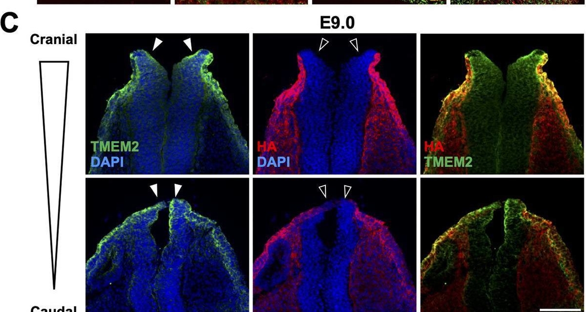 Fig.2.C showing Immunohistochemistry-immunofluorescence in a Mus musculus (House mouse) sample from the publication: The cell surface hyaluronidase TMEM2 plays an essential role in mouse neural crest cell development and survival.