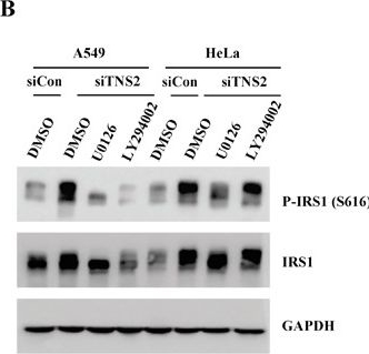 Fig.6.B showing Western Blotting from the publication: Down-regulation of tensin2 enhances tumorigenicity and is associated with a variety of cancers.