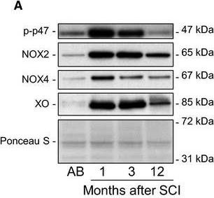 Fig.3.A showing Western Blotting in a Homo sapiens (Human) sample from the publication: Altered oxidative stress and antioxidant defence in skeletal muscle during the first year following spinal cord injury.