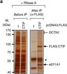 Fig.2.A showing Western Blotting in a Homo sapiens (Human) sample from the publication: Misfolded polypeptides are selectively recognized and transported toward aggresomes by a CED complex.