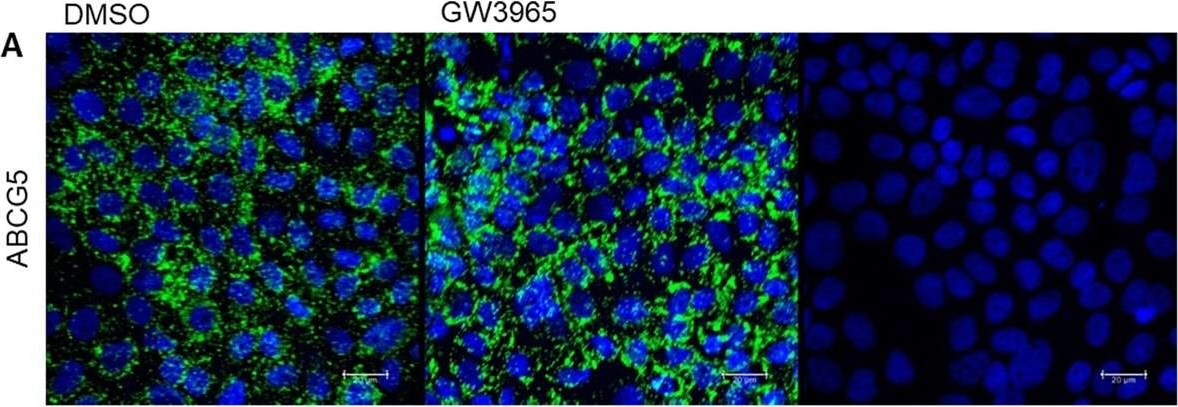 Fig.6.A showing Immunocytochemistry-immunofluorescence in a Homo sapiens (Human) sample from the publication: Caco-2 Cells for Measuring Intestinal Cholesterol Transport - Possibilities and Limitations.