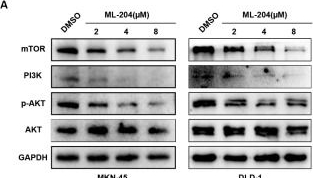 Fig.3.A showing Western Blotting from the publication: Pharmacological manipulation of TRPC5 by kaempferol attenuates metastasis of gastrointestinal cancer via inhibiting calcium involved in the formation of filopodia.