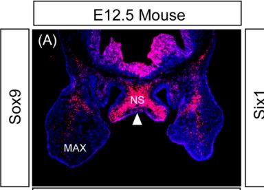 Fig.3.A showing Immunohistochemistry-immunofluorescence from the publication: Expression analysis of genes including Zfhx4 in mice and zebrafish reveals a temporospatial conserved molecular basis underlying craniofacial development.
