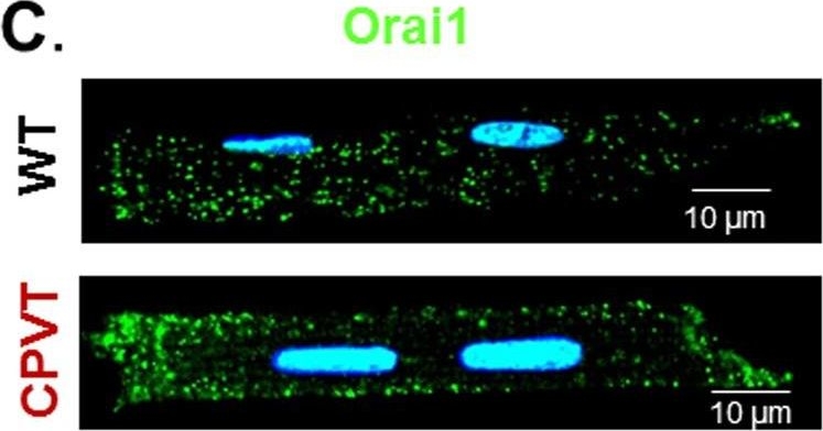 Fig.7.C showing Immunofluorescence in a Mus musculus (House mouse) sample from the publication: Enhancement of Cardiac Store Operated Calcium Entry (SOCE) within Novel Intercalated Disk Microdomains in Arrhythmic Disease.