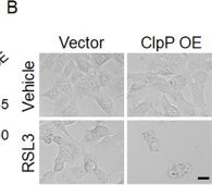 Fig.4.B showing Immunohistochemistry in a Homo sapiens (Human) sample from the publication: ZK53 enhances tumor cell susceptibility to ferroptosis via ClpP-mediated mitochondrial dysfunction.