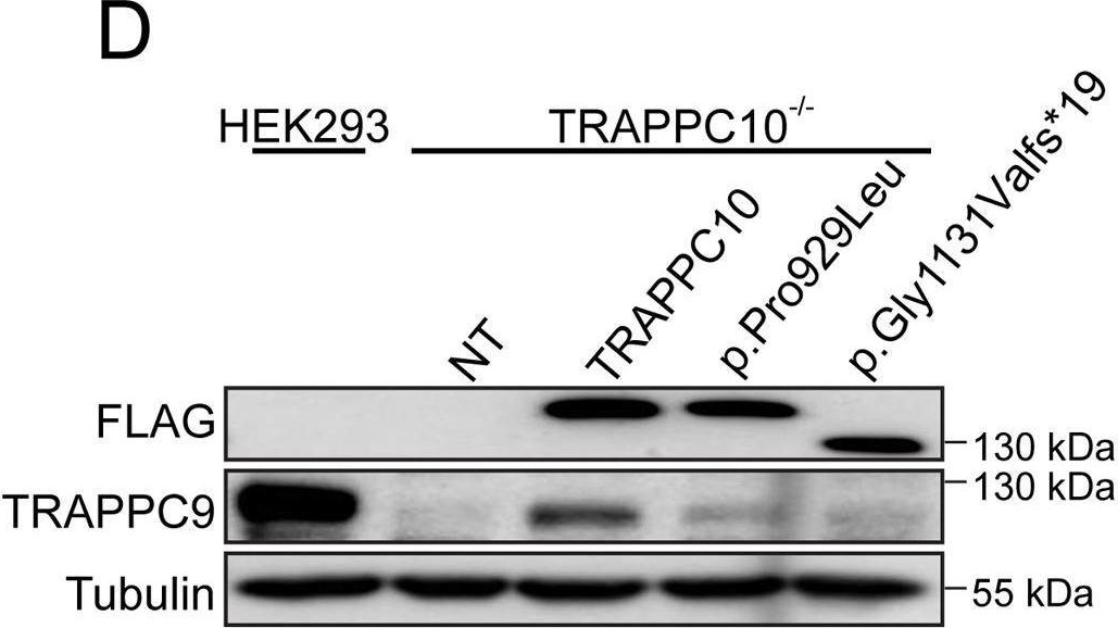 Fig.3.D showing Western Blotting from the publication: Biallelic variants in TRAPPC10 cause a microcephalic TRAPPopathy disorder in humans and mice.