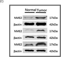 Fig.5.C showing Western Blotting from the publication: Machine learning-derived cellular senescence index for predicting prognosis and drug sensitivity in patients with renal cell carcinoma.