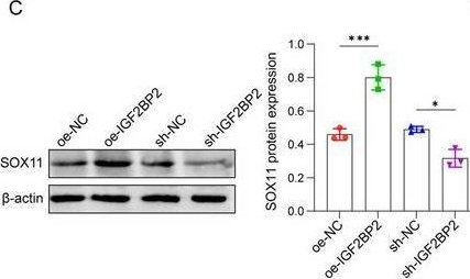 Fig.6.C showing Western Blotting from the publication: DeSUMOylation of IGF2BP2 Promotes Neuronal Differentiation of OM-MSCs by Stabilizing SOX11 to Ameliorate Brain Injury After Intracerebral Hemorrhage.