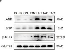 Fig.5.E showing Western Blotting from the publication: Integrated analysis of cell-in-cell related genes and immune microenvironment in heart failure.