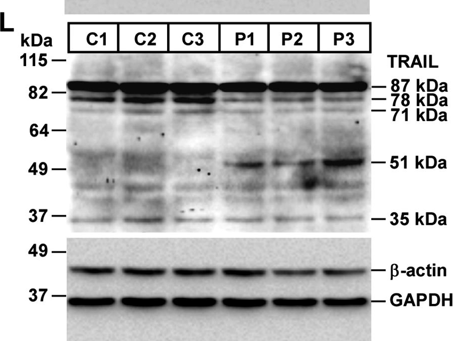 Fig.8.L showing Western Blotting in a Mus musculus (House mouse) sample from the publication: Molecular signatures in prion disease: altered death receptor pathways in a mouse model.