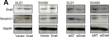 Fig.5.A showing Western Blotting in a Homo sapiens (Human) sample from the publication: Snail and serpinA1 promote tumor progression and predict prognosis in colorectal cancer.