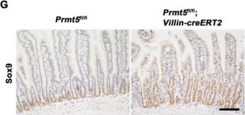 Fig.4.G showing Immunohistochemistry from the publication: Prmt5 is essential for intestinal stem cell maintenance and homeostasis.