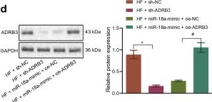 Fig.5.D showing Western Blotting from the publication: The crosstalk of HDAC3, microRNA-18a and ADRB3 in the progression of heart failure.