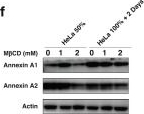 Fig.6.F showing Western Blotting from the publication: Quiescent cancer cells induced by high-density cultivation reveals cholesterol-mediated survival and lung metastatic traits.