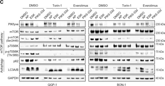 Fig.5.C showing Western Blotting in a Homo sapiens (Human) sample from the publication: Targeting the ferritinophagy-lysosome axis as a therapeutic vulnerability in gastroenteropancreatic neuroendocrine tumors.
