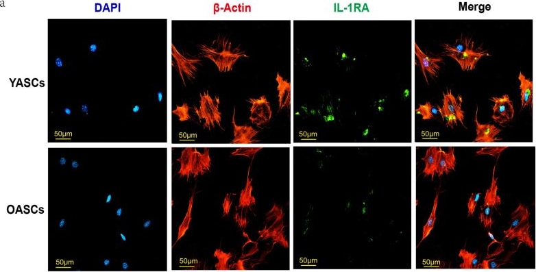 Fig.3.A showing Immunocytochemistry-immunofluorescence from the publication: Interleukin-1 Receptor Antagonist (IL-1RA) Mediates Age-Dependent Immunoregulation of Adipose-Derived Stem Cells via Macrophage Polarization.
