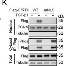 Fig.8.K showing Western Blotting from the publication: Nuclear translocation of SIRT4 mediates deacetylation of U2AF2 to modulate renal fibrosis through alternative splicing-mediated upregulation of CCN2.