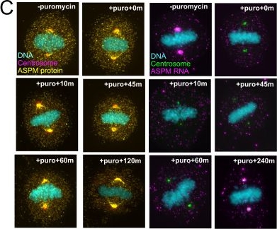 Fig.1.C showing Immunocytochemistry-immunofluorescence in a Homo sapiens (Human) sample from the publication: Differential subcellular localization of ASPM RNA and protein.