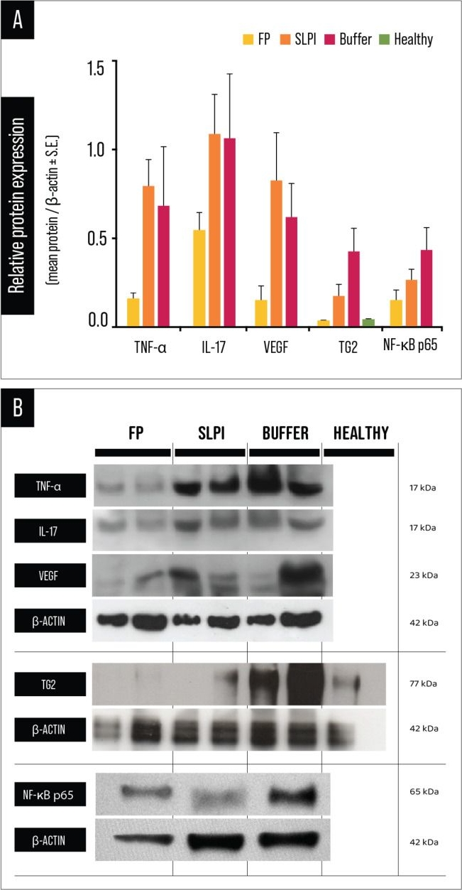 Fig.9.A showing Western Blotting from the publication: Downregulation of the Transglutaminase 2-NF-κB Inflammatory Axis by a Fusion Protein of Cementoin and Secretory Leukocyte Protease Inhibitor Reduces Corneal Angiogenesis.