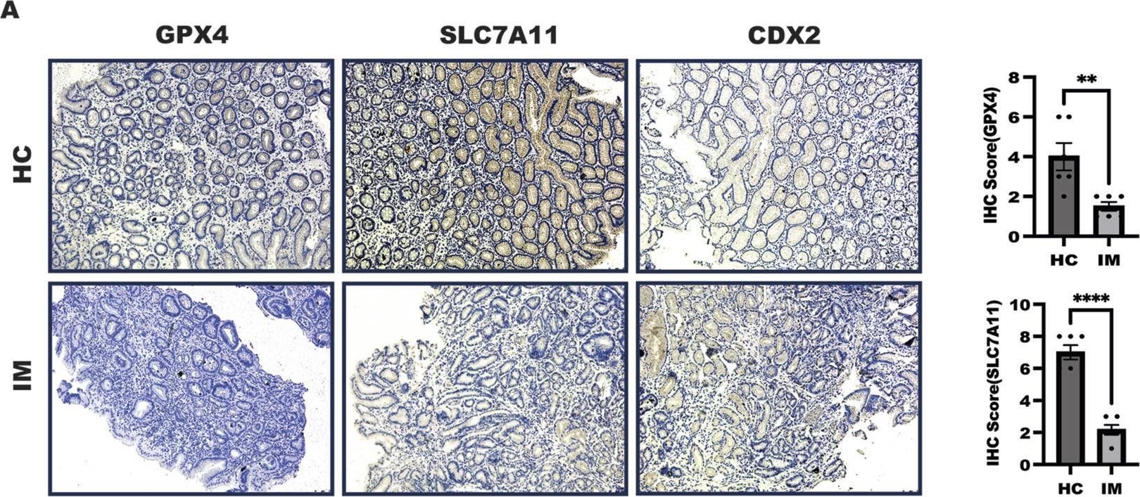 Fig.5.A showing Immunohistochemistry in a Homo sapiens (Human) sample from the publication: Rabeprazole suppressed gastric intestinal metaplasia through activation of GPX4-mediated ferroptosis.